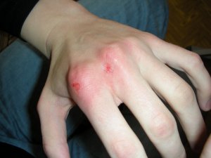 Оружие ревности — кулак ... и нож